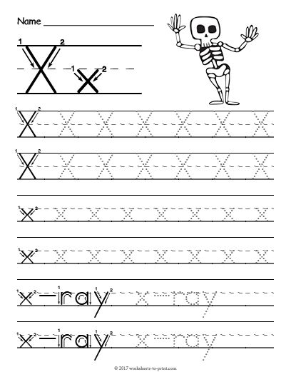 Free Printable Tracing Letter X Worksheet